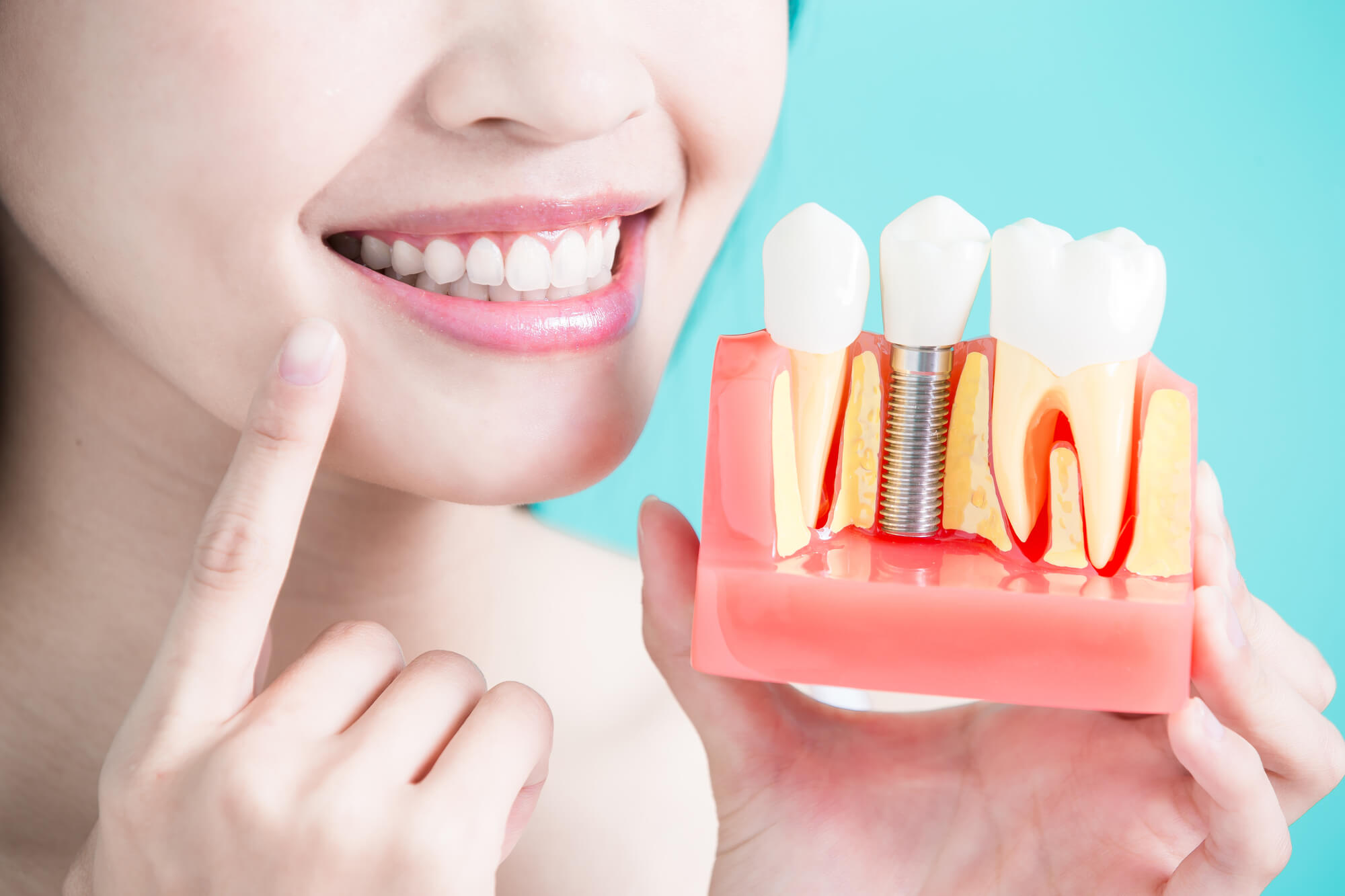 Woman holding tooth implant model on green background in Lisle, IL